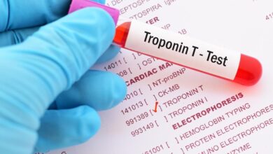 troponin nedir